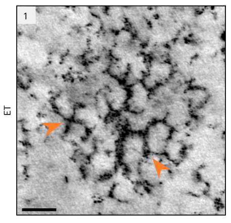 Jonathan Dragwidge (@jm_dragwidge) on Twitter photo Out now in <a href="/NatureCellBio/">Nature Cell Biology</a>. We report that the plant endocytic complex, the TSET–TPLATE complex, undergoes biomolecular condensation through interactions with plasma membrane phospholipids and recruits clathrin during endocytosis.
rdcu.be/dyqAO Out now in <a href="/NatureCellBio/">Nature Cell Biology</a>. We report that the plant endocytic complex, the TSET–TPLATE complex, undergoes biomolecular condensation through interactions with plasma membrane phospholipids and recruits clathrin during endocytosis.
rdcu.be/dyqAO