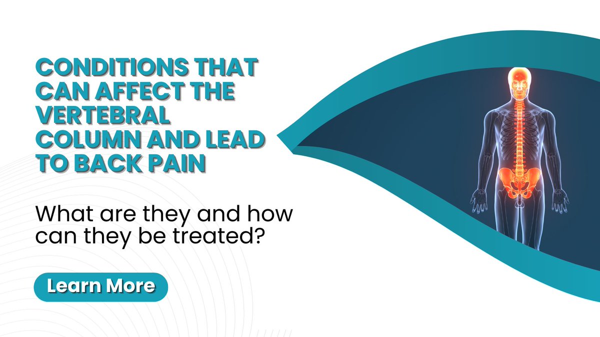 BackRackUK's tweet photo. Find out how to effectively relieve pain that affects the vertebral column by following the link below.

https://t.co/PbqeBs4br2

#painrelief #backpain #backexercises #spinehealth https://t.co/sadf1UcjpX