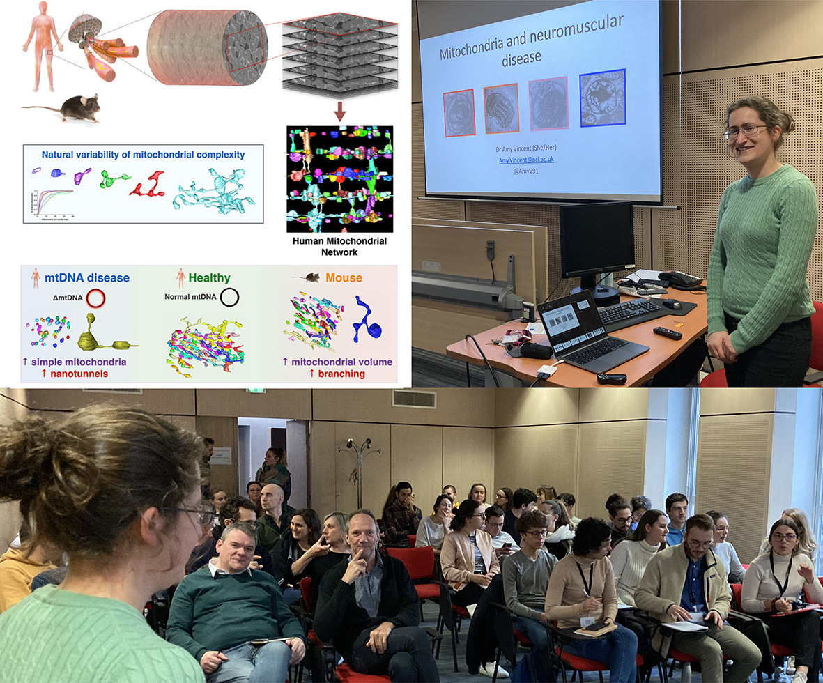 Chevrollier Arnaud (@chevrolliera) on Twitter photo Many thanks to Dr Amy Vincent of the Wellcome Centre for Mitochondrial Research Translational and Clinical Research Institute in Newcastle for her fascinating presentation.
#mitoresearch <a href="/Mito_News/">Mitochondria News</a> <a href="/icat_sfr/">SFR ICAT</a>
<a href="/chu_angers/">CHU Angers</a> @FacSante_Angers
<a href="/icat_sfr/">SFR ICAT</a> <a href="/mitovasc/">MitoVasc</a> <a href="/UA_Recherche/">Recherche et Innovation – Université d’Angers​</a> Many thanks to Dr Amy Vincent of the Wellcome Centre for Mitochondrial Research Translational and Clinical Research Institute in Newcastle for her fascinating presentation.
#mitoresearch <a href="/Mito_News/">Mitochondria News</a> <a href="/icat_sfr/">SFR ICAT</a>
<a href="/chu_angers/">CHU Angers</a> @FacSante_Angers
<a href="/icat_sfr/">SFR ICAT</a> <a href="/mitovasc/">MitoVasc</a> <a href="/UA_Recherche/">Recherche et Innovation – Université d’Angers​</a>