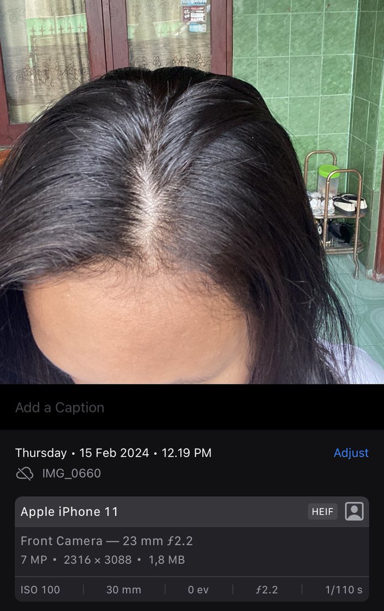 udah di tahap pasrah sama rambut sendiri, krn gen rambut di keluargaku gampang rontok alhasil rambutku tuh jadi tipiiisss. bahkan ada bagian botaknya. 🤣

tp KAGETTT BGT akhirnya nemu produk yg bisa ngurangin rontok aku dlm 2 minggu. 😭🤍