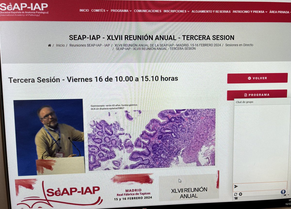 Tercera sesión , reunión anual de la SEAP-IAP. Lesiones preneoplasicas en tracto gastrointestinal ⁦@SEAP_IAP⁩ ❤️