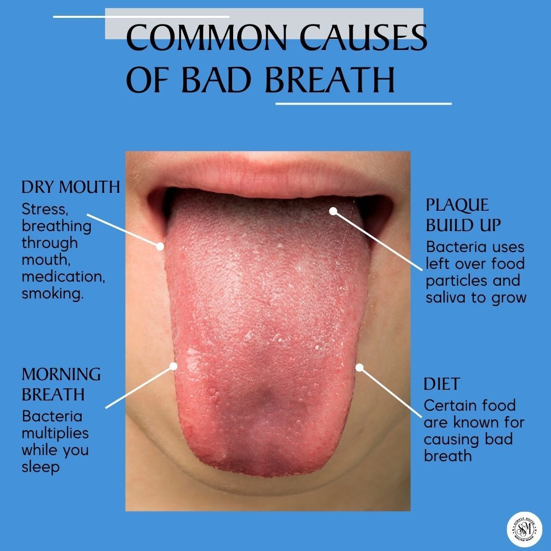 Do you have stank breath? Here are some underlying causes. Make sure to use a tongue scraper as most bad breath comes from the back of the tongue. Avoid products using alcohol as they can make bad breath worse.
.
.
 #badbreath #oralhygiene #tonguescraper #freshbreath #dentalcare