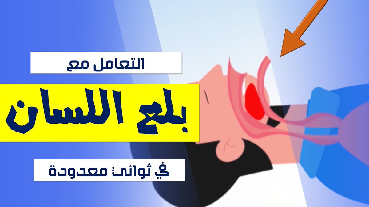 بلع اللسان‼️

ربما رأيت أو سمعت عن شخص أو لاعب بلع لسانه وربما يموت الشخص فيها!!

اولا هذا التعبير خاطيء ..لماذا؟
لأن الإنسان مستحيل أن يبلع لسانه
لذا من الخطأ إدخال اليد لسحب اللسان ، إنما هناك طريقة خاصة لانقاذ المصاب.

فعندما يفقد الإنسان الوعي ،يرتخي الجسم كله ،بما فيها الفك