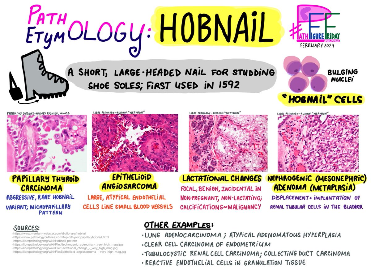alex_tatarian's tweet photo. It’s #PathFigureFriday! 🥾 Here I share diagrams for concepts I’m learning. Please add any comments, corrections, or creations of your own!

#PathTwitter #PathX #MedX 
#MedTwitter #etymology 
#hobnail #shoes #cells #PathArt 

⬇️More:
https://t.co/Xme45LAw6F https://t.co/m1KSOydo5D