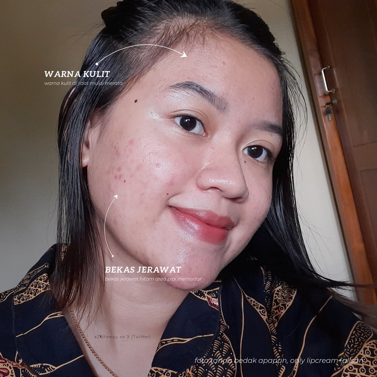 AAAAAAAA masih rutinin pake Brightening series Glad2Glow yang Pomegranate ini.
memilih dan menobatkan mereka sebagai duo produk brightening ter-gentle. gapernah ngerasa muka secerah ini seriussss🥲💗