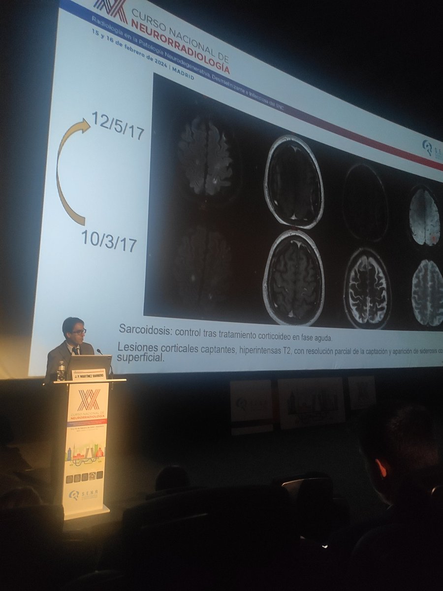 Superlativo este último bloque de CursonSenr2024 sobre enfermedades desmielinizantes @residentesSERAM