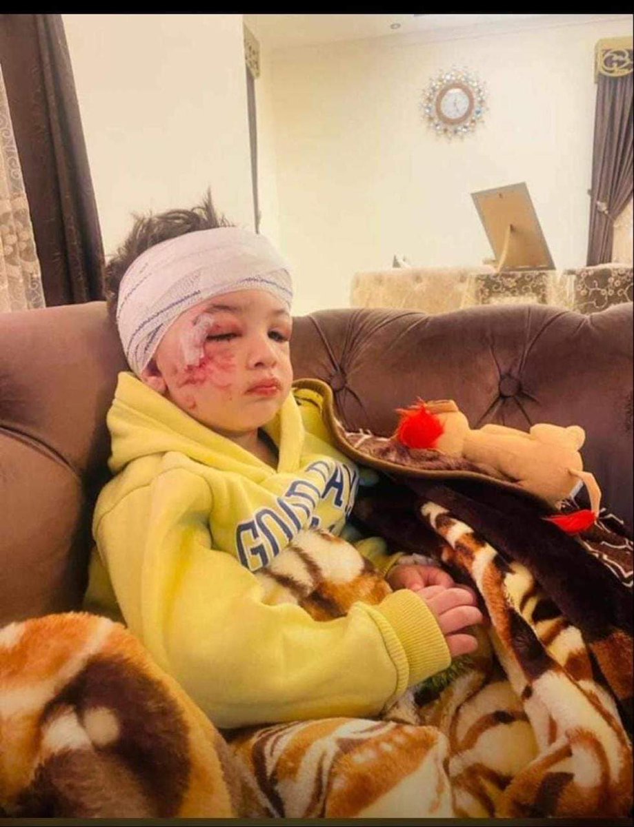 يتيماً عاد إلى منزله الطفل حسين عامر الذي نجا من مجزر.ة #النبطية