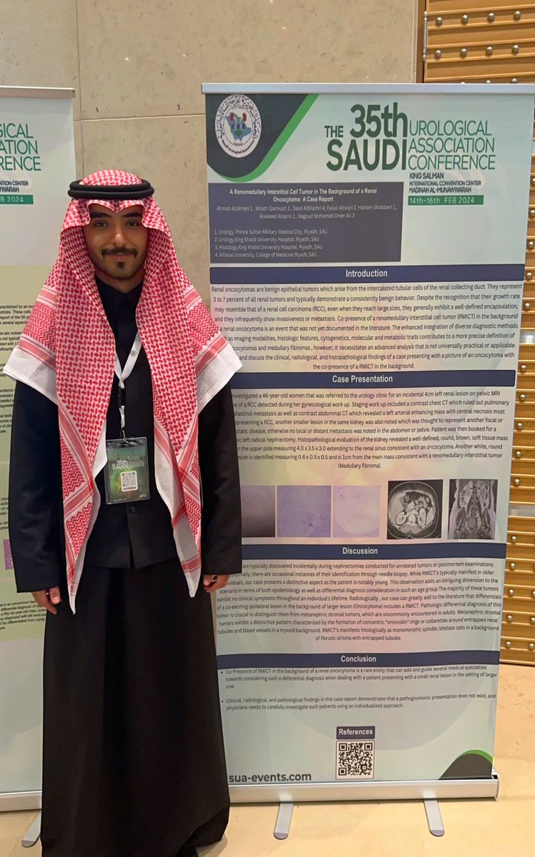 SaadShathry's tweet photo. سعيد بحضوري للمؤتمر السنوي الخامس والثلاثون للجمعية السعودية لجراحة الكلى والمسالك البولية ، وتشرّفت بتقديم بحثنا العلمي في مجال أورام الجهاز البولي. #SUA35 @saudiurological 

الشكر موصول للدكتور أحمد الزهراني على اتاحة الفرصة والدعم المتواصل. @drzahrani https://t.co/dhJEoqnyBe