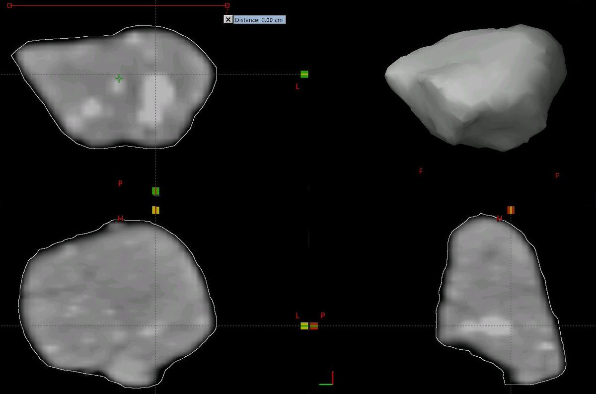 TopperBerlin's tweet photo. CT-scan (1mm resolution, 120kV) from my #2024BX1 specimen and 3D-Reconstruction (upper right). Despite of the rather low resolution different densities are good visible. https://t.co/if8Jqat857