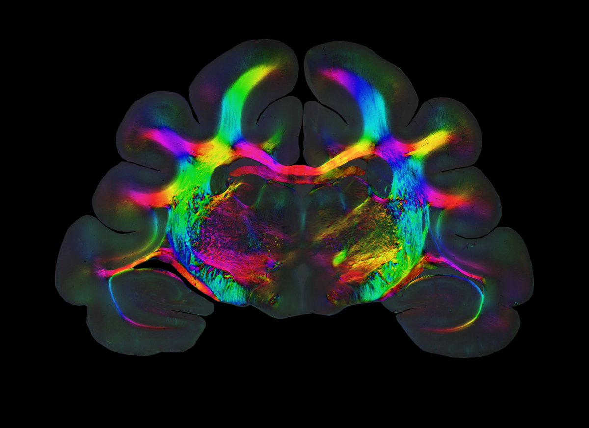 📢 We are hiring postdocs for our ERC SyG UNFOLD!! Join the Borrell Lab to study the genomic bases of cerebral cortex folding @BorrellLab @NeuroAlc @CsicLifehub Click here for job details and how to apply vborrelllab.wixsite.com/website/news-1