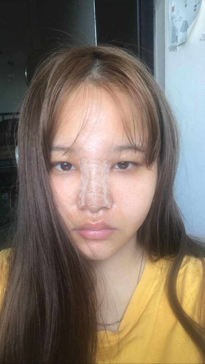 เฟินเองไม่ใช่เฟินแอ๊ง🥯 tweet media