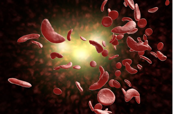 A new CMS model aims to lower the cost of, and improve accessibility to gene therapies for sickle cell disease. This shortly follows the approval of 2 cell-based gene therapy treatments in December 2023.  Click the link to learn more. bit.ly/42xQUQ5