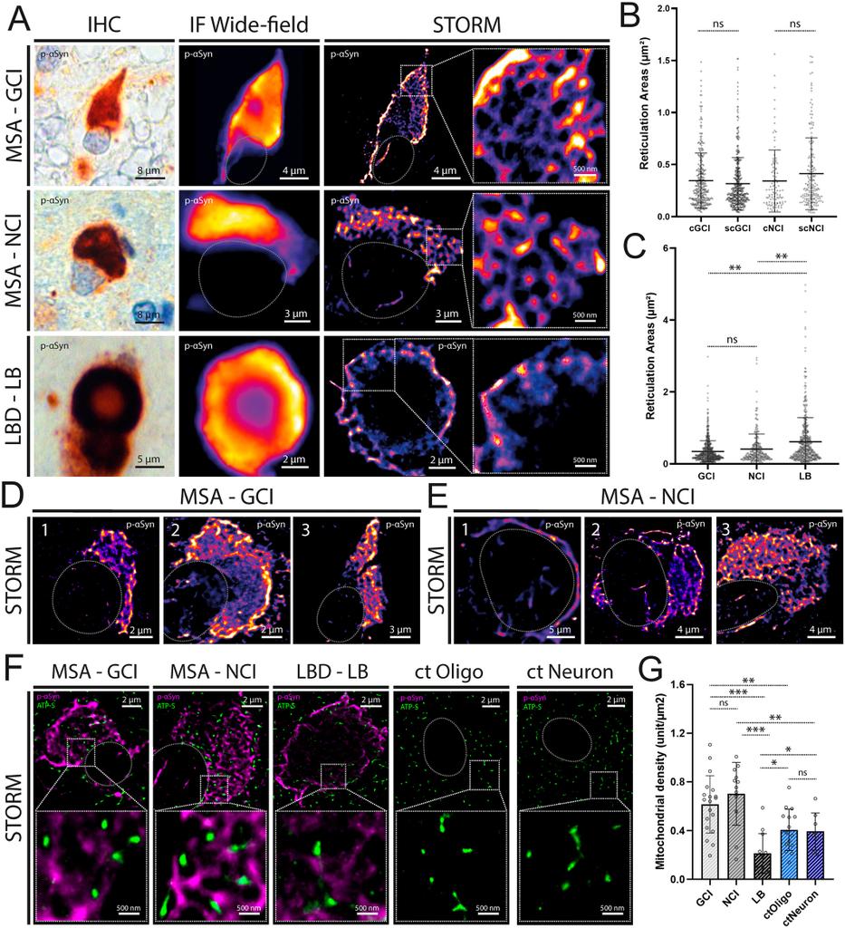 SFR ICAT (@icat_sfr) on Twitter photo Stochastic Optical Reconstruction Microscopy Imaging of Multiple System Atrophy Inclusions Suggests Stepwise α-Synuclein Aggregation
Congrats <a href="/mitovasc/">MitoVasc</a> 👍
…mentdisorders.onlinelibrary.wiley.com/doi/10.1002/md…
<a href="/chu_angers/">CHU Angers</a> @FacSante_Angers <a href="/UA_Recherche/">Recherche et Innovation – Université d’Angers</a> Stochastic Optical Reconstruction Microscopy Imaging of Multiple System Atrophy Inclusions Suggests Stepwise α-Synuclein Aggregation
Congrats <a href="/mitovasc/">MitoVasc</a> 👍
…mentdisorders.onlinelibrary.wiley.com/doi/10.1002/md…
<a href="/chu_angers/">CHU Angers</a> @FacSante_Angers <a href="/UA_Recherche/">Recherche et Innovation – Université d’Angers</a>
