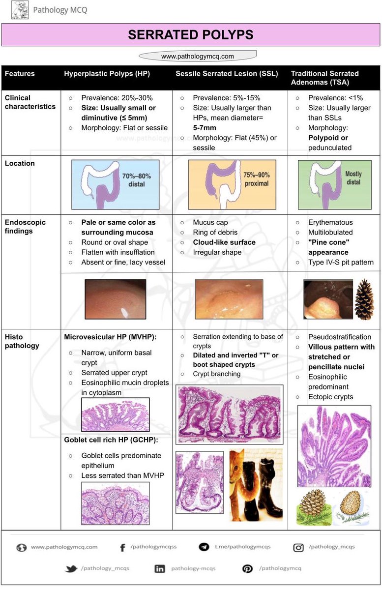 Differential diagnosis of serrated polyps #pathteitter #gipath #polyps