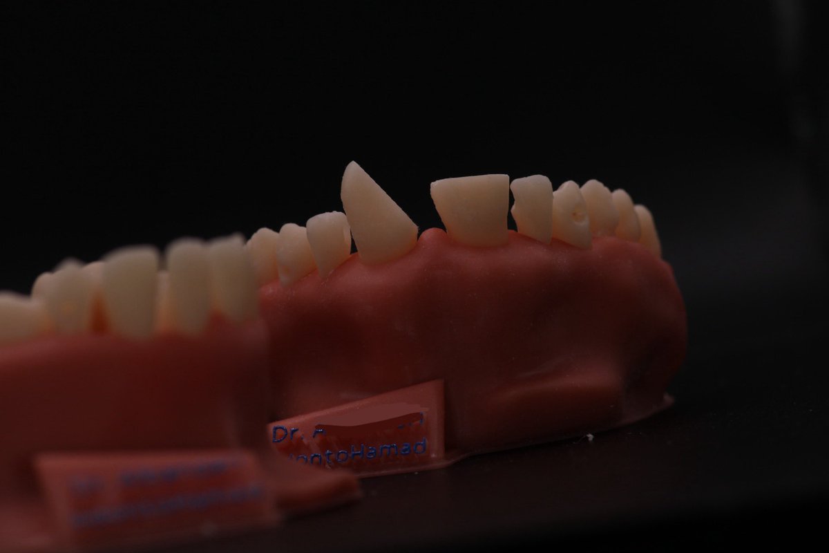 جانا طلب خاصة ، خصخص فيه الفك علوي و سفلي و اختار Mixed Dentition with combination of Ellis and G.V Black classification 
و حبينا نطلع عن الروتين و سوينا اختبار بسيط لطيف نسئل فيها صاحب الطلب عن عمر المريض الي صمم هو نوع التدريب بناء على الاسنان الي اختارها في الفك 🤣🫡