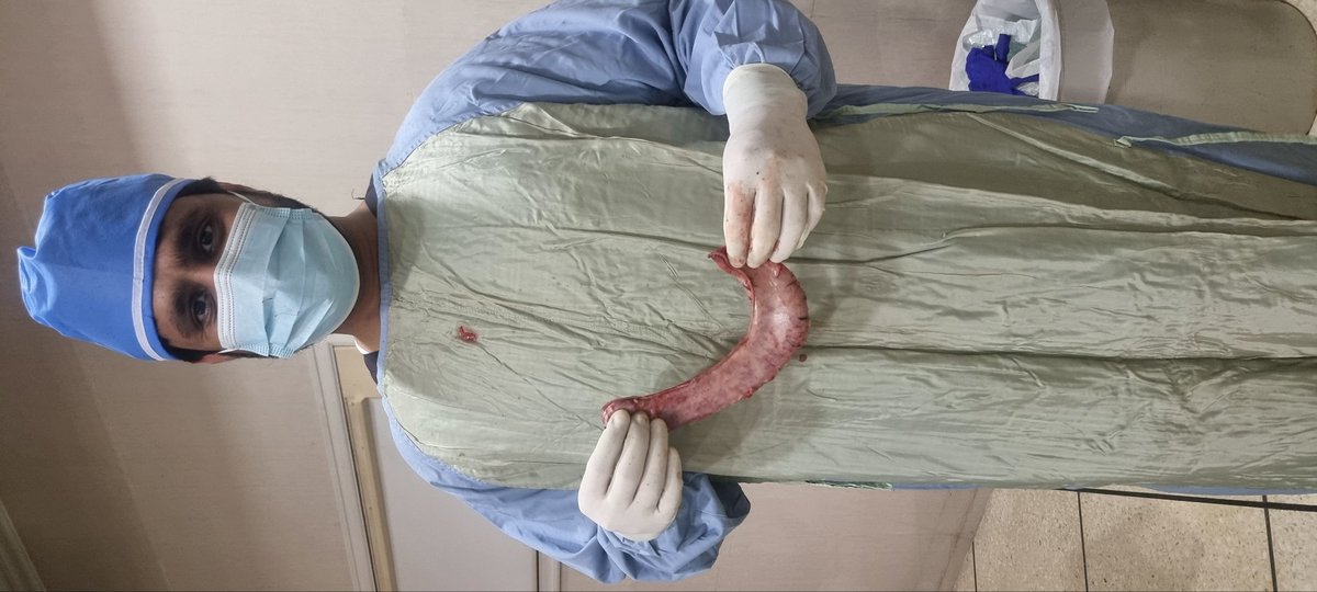 drsamibhatti's tweet photo. The future belongs to those who keeps on evolving and progressing forward...!!!

#bariatricsurgery #bariatric #bariatriclife #bariatriccommunity #obesityawareness #obesity #obesitytreatment #obesityisadisease https://t.co/b578KMX84P