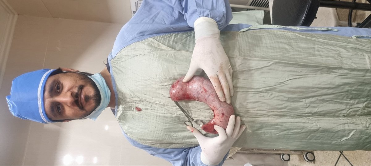 drsamibhatti's tweet photo. The future belongs to those who keeps on evolving and progressing forward...!!!

#bariatricsurgery #bariatric #bariatriclife #bariatriccommunity #obesityawareness #obesity #obesitytreatment #obesityisadisease https://t.co/b578KMX84P