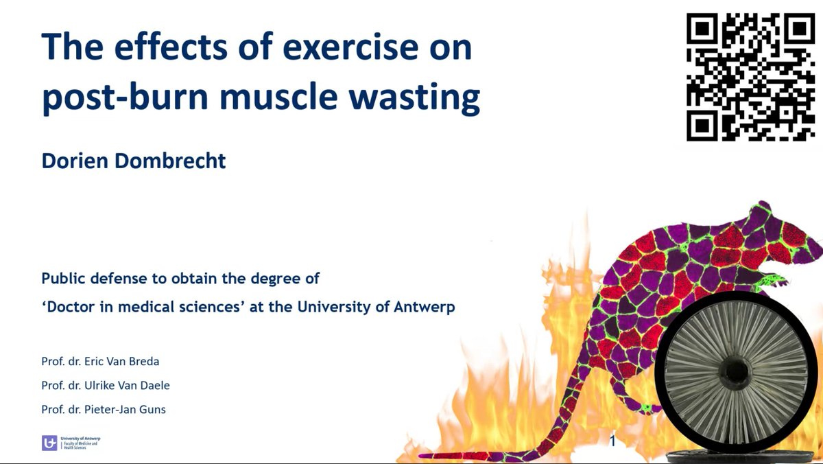 DRSchieffelers's tweet photo. Congratulations to Dr. Dorien Dombrecht! 🎉 It's been an honour to do research together over the last 4 years! Your PhD has added a lot of insight into the mechanisms of postburn muscle wasting and exercise! Well done! @DorienDombrecht @MOVANTresearch https://t.co/CGFi0U8Qya