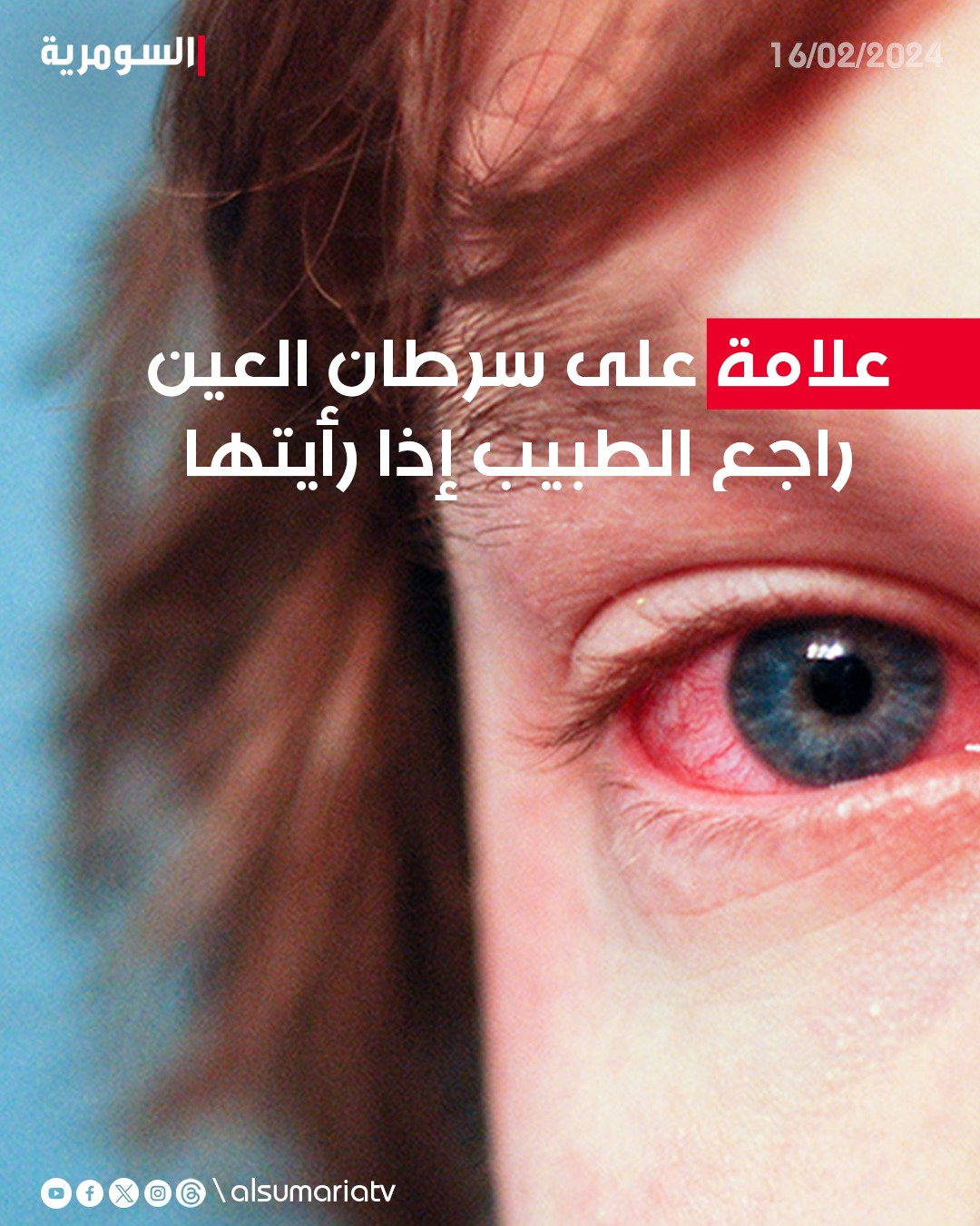 قناة السومرية | بينها الاحمرار.. اعراض سرطان العين واسبابها