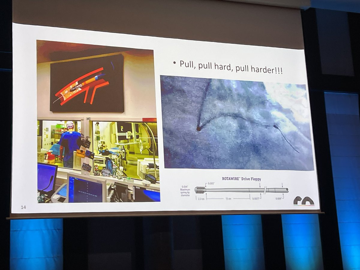 stefan_harb's tweet image. Felix Woitek showed a great collection of #rotablation challenges at #GERMANCTO2024