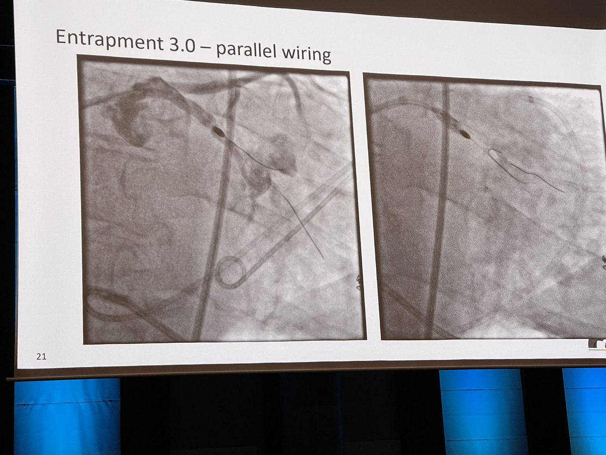 stefan_harb's tweet image. Felix Woitek showed a great collection of #rotablation challenges at #GERMANCTO2024