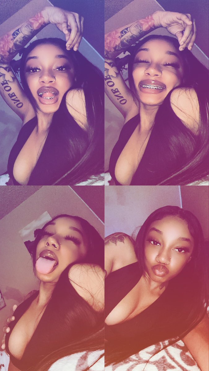 fineassslay's tweet photo. my braces 😕 https://t.co/aTW8vCXrGy