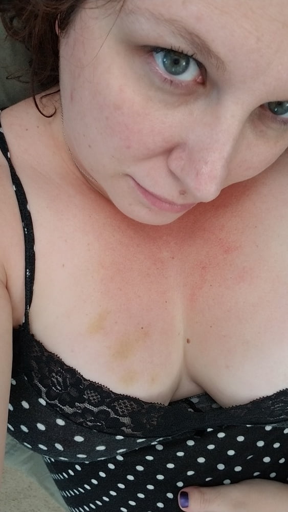 would you notice them? even though they are small?? 🍒