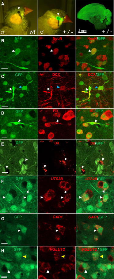 This week’s #ResearchSpotlight is on the Shvedov et al. (2024) publication, “In vivo imaging in transgenic songbirds reveals superdiffusive neuron migration in the adult brain.”

#HCRimaging helped Shvedov et al. investigate the expression of GFP in different neuronal subtypes