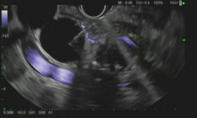 Erik Holzwanger, MD, ABOM-D tweet media