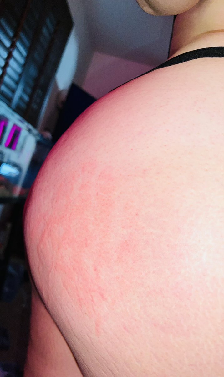 jessieraeduh's tweet photo. Pain is such a sudden rush for me! 
Stan 
I love when he smacks my ass while he fucks me! #asssmack #milf #curvy #Contentcreater #naughty #handprint #hurtme #consenualofcourse https://t.co/MWp93zARN5