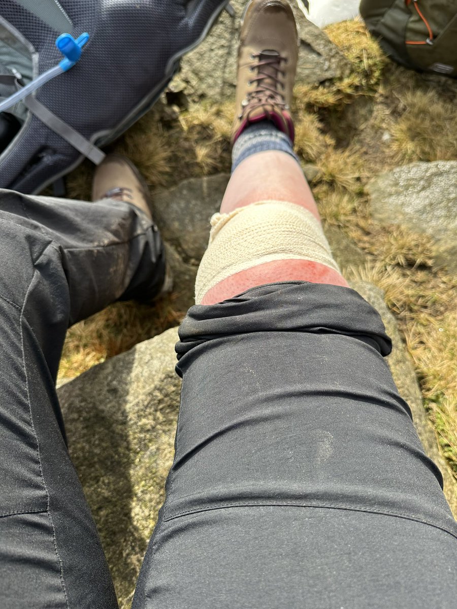 Gemmastones2's tweet photo. Well we kick started our half term with me in hospital 4stitches later not able to walk. Had my own nurse telling me I had grass in my knee we have stayed home and went to see our friends the goats and small and slow walks. I well be back on the fells where we love to be https://t.co/ePZs5rE8gB