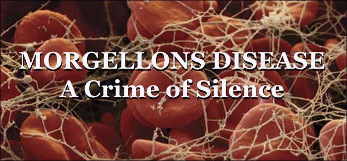 jamaica_witch's tweet image. viewzone.com/morgellonsx.ht…
#morgellons