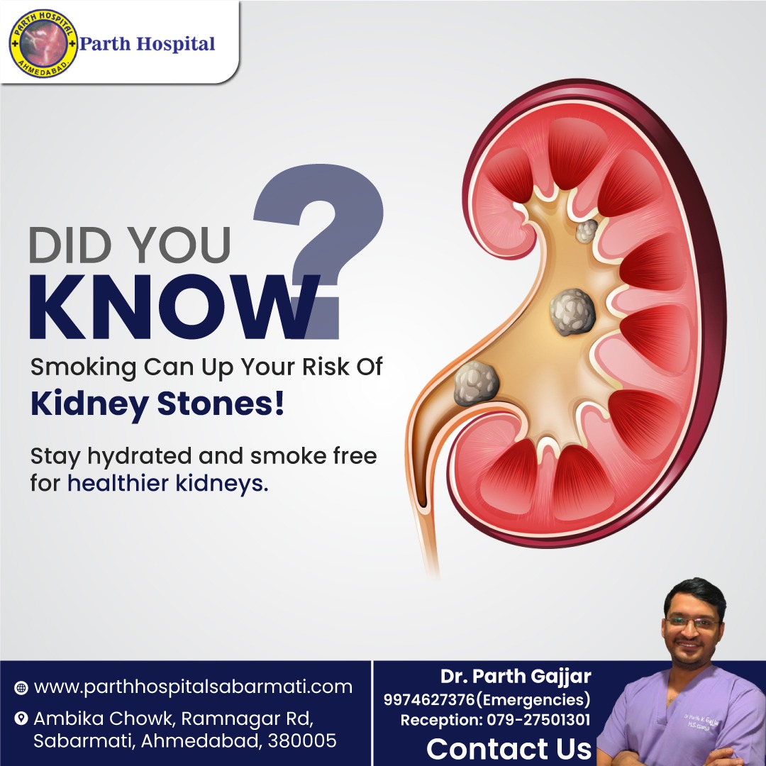 parthhospital06's tweet photo. Did you know?
Smoking can up your risk of kidney stones! 
Stay hydrated and smoke-free for healthier kidneys.

#ParthHospitalsabarmati #KidneyStones #QuitSmoking #StonePain #KidneyHealth #StonePrevention #StayHydrated #HealthyLiving #StoneFree #DrinkWater #StoneFreeZone https://t.co/Lm9c8tZdiG