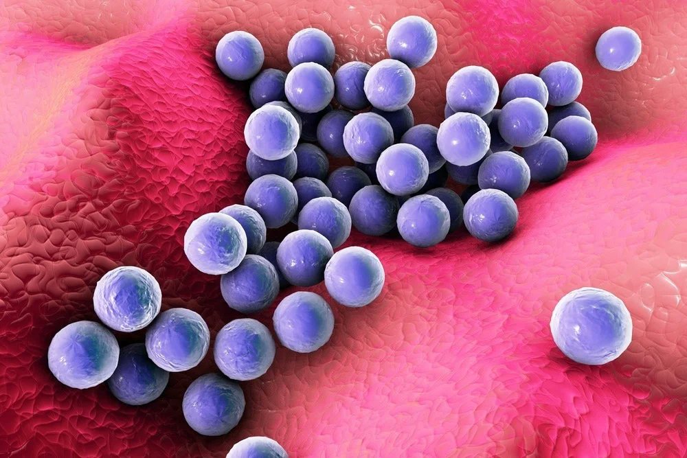 InfectDisMicrob's tweet photo. Staphylococcus aureus is a nosocomial bacterium causing infectious diseases, ranging from skin and soft tissue infections to more serious and life-threatening infections.
#nosocomial #cells #infectious #antibacterialdrug #staphylococcus #dehydration #sessile #biofilm #aureus #RNA https://t.co/4068RmrfVJ