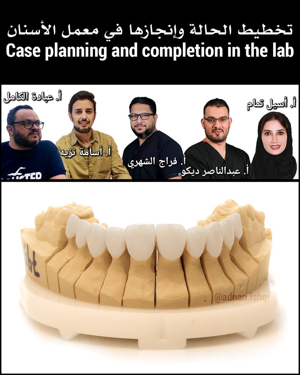 تخطيط الحالة وتحضيرها وإنجازها في معمل الأسنان يتطلب فريق عمل متكامل ومتمكن لإنجازها!
Planning, preparing, and completing  the cases in the dental laboratory requires an integrated and proficient team to accomplish it!