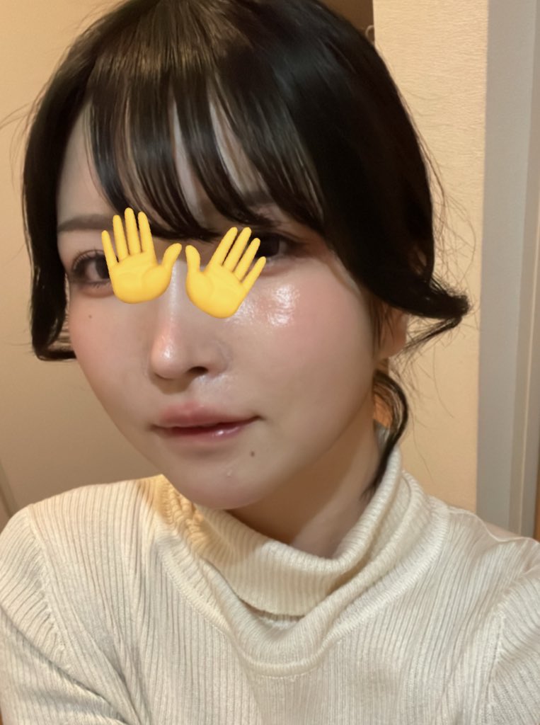 mochimarumemo's tweet photo. 鼻孔縁挙上で、小鼻の厚みが取れて小鼻の厚みから来る小鼻横の影がなくなったからかなり忘れ鼻になった(言いたいこと伝わる？) https://t.co/Y4sLb1ybk7