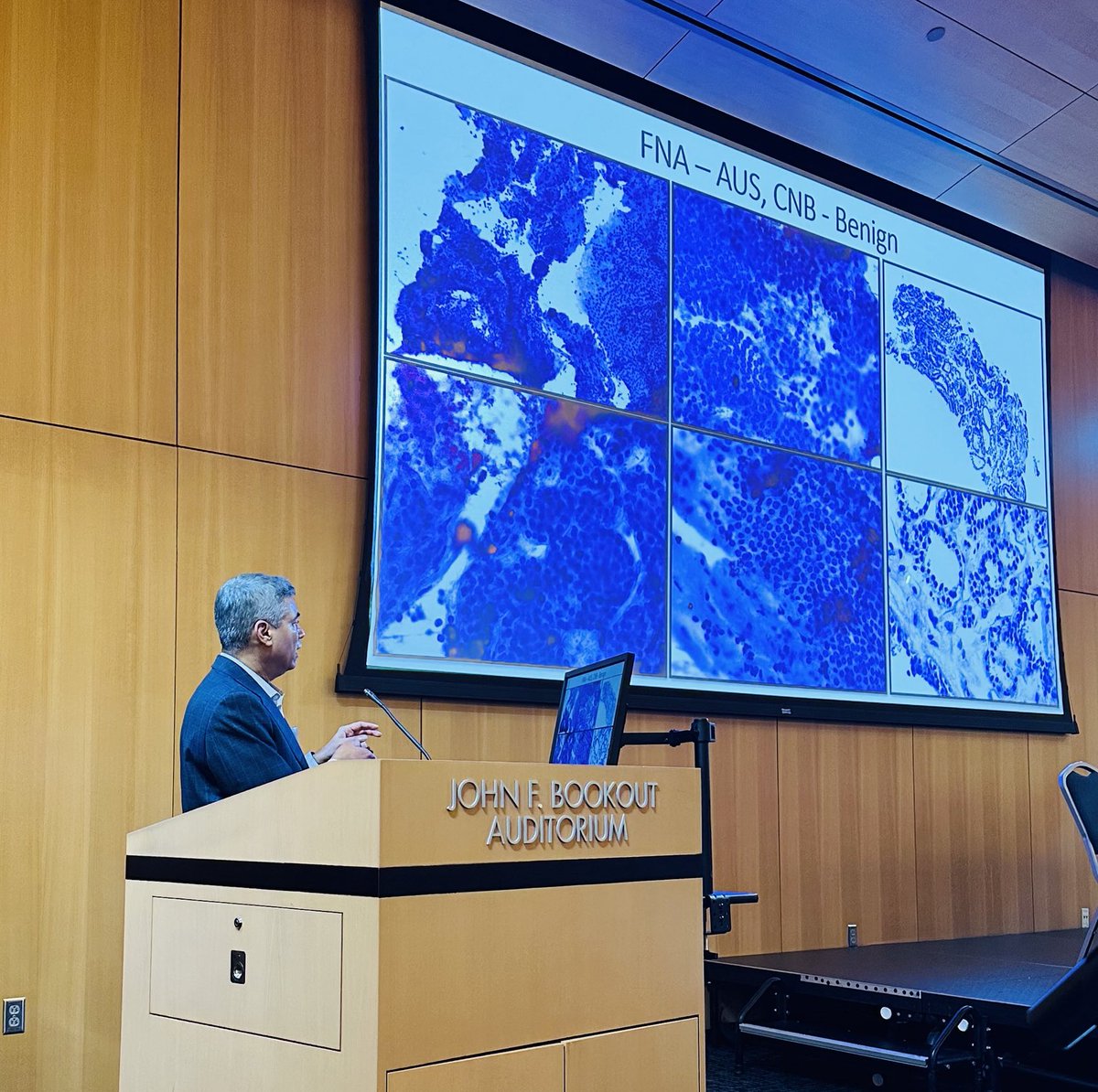 Dr Zubair Baloch on Thyroid cytopatholand small biopsies. At the cytopath and small biopsy updates at Houston Methodist Hospital in the Texas Medical Center