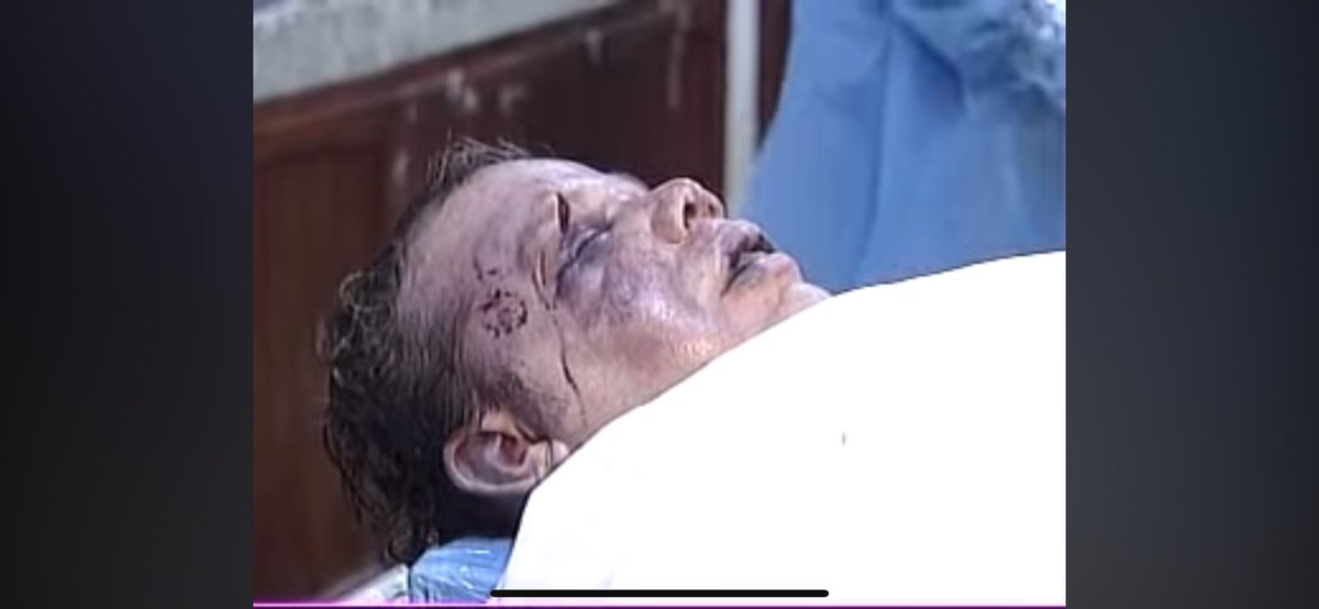 mhsjs8875's tweet photo. Imágenes del cadaver de Miky Breton luego de su muerte https://t.co/4gghRC4ZJT