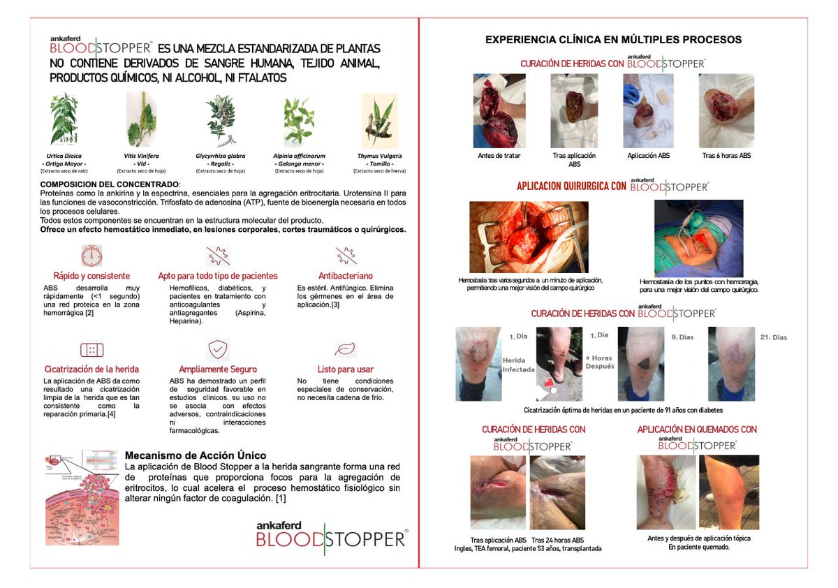 Davidgbailen's tweet photo. Pásate por el stand ANkAFERD y te daremos a conocer esta NOVEDAD que llega a España: hemostático y para solucionar heridas complejas........ 
@SEHERidas #12CongresoSEHER  #heridas https://t.co/LMZKGknRH9