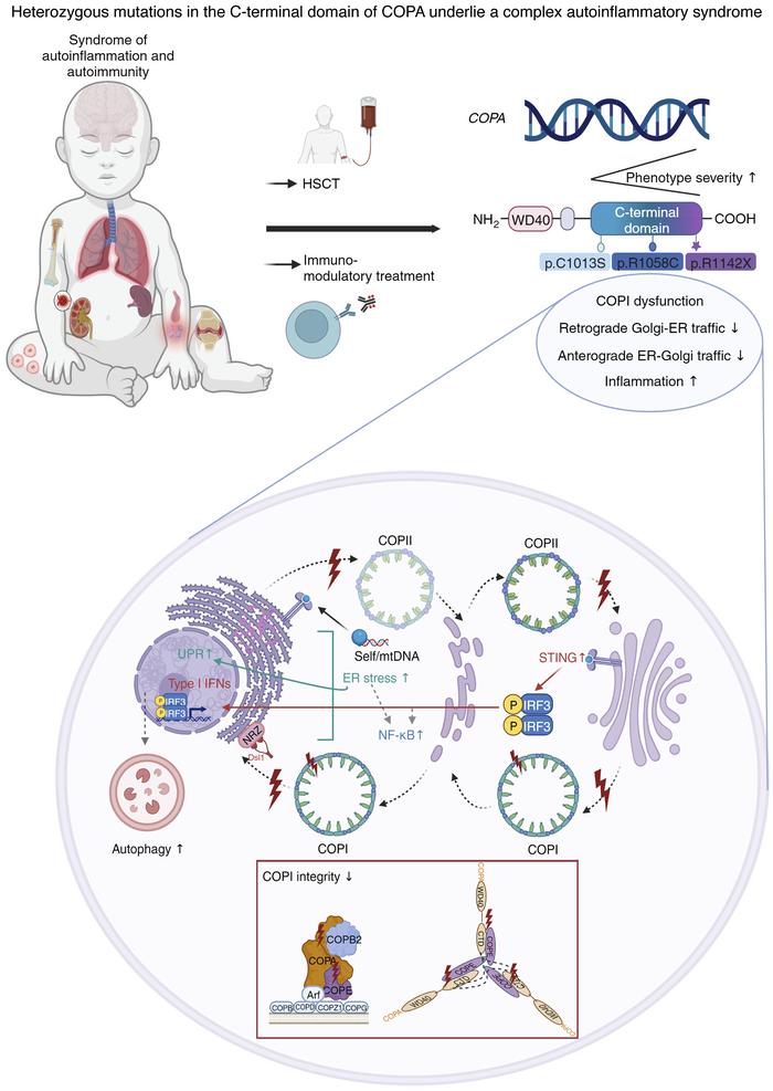 Selket Delafontaine (@s_delafontaine) on Twitter photo 1/🎉Thrilled to announce in this week's <a href="/jclinicalinvest/">Journal of Clinical Investigation</a>: validation of heterozygous mutations in COPA's C-terminal domain as a cause of a complex autoinflammatory syndrome (jci.org/articles/view/…)!
Utterly grateful to <a href="/IsabelleMeyts/">Isabelle Meyts</a> and all our collaborators (at thread's end)! 1/🎉Thrilled to announce in this week's <a href="/jclinicalinvest/">Journal of Clinical Investigation</a>: validation of heterozygous mutations in COPA's C-terminal domain as a cause of a complex autoinflammatory syndrome (jci.org/articles/view/…)!
Utterly grateful to <a href="/IsabelleMeyts/">Isabelle Meyts</a> and all our collaborators (at thread's end)!