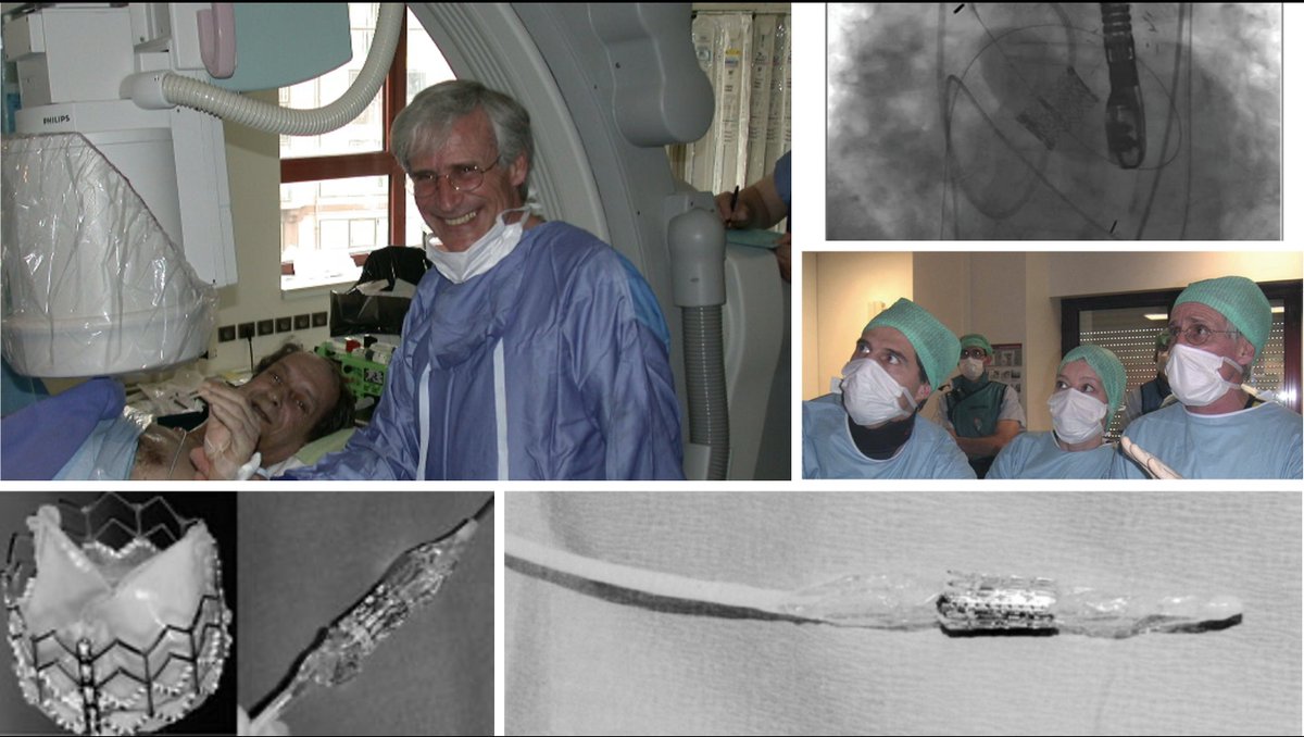 RIP to Dr. Alain Cribier He performed the first-in-man #TAVR on April 16, 2002. The courage of the team and the patient was the start of the TAVR evolution. The world has lost one of its greatest pioneers in medicine.