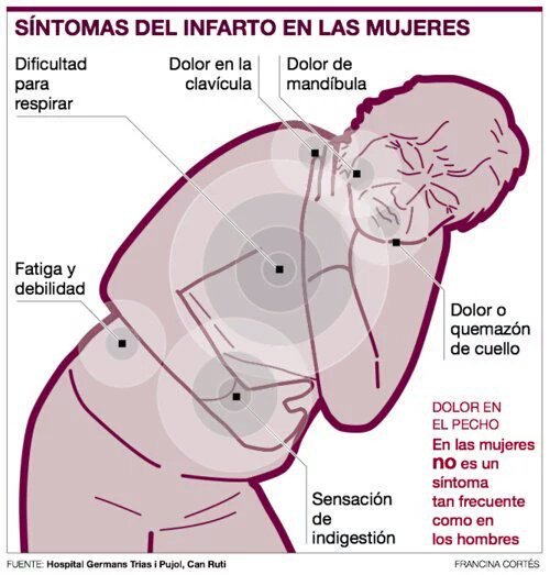 XoseCastro's tweet photo. 4/5
En el campo de la medicina, podrían escribirse libros enteros sobre errores de diagnóstico y mala divulgación debido a una investigación centrada en los hombres, o la ausencia de investigación (endometriosis, VPH, orgasmo femenino, menopausia...).

Una buena cantidad de fármacos que podrían servir para mujeres se han descartado porque no funcionaban en hombres. 

Aun hoy en día, muchos profesionales de la salud no reconocen los síntomas del infarto femenino (fatiga profunda, dolor de cuello, mandíbula, náusea...), que no cursa como el típico en un hombre (dolor de pecho, brazo izquierdo...).

CHORPRECHA: La Fundación Española del Corazón indica que la mortalidad tras sufrir un infarto de miocardio es del 30% para hombres, pero... del 50 % para mujeres (¡!).