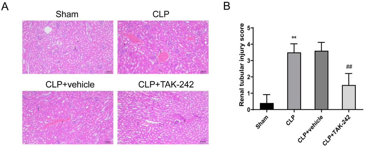 🔬🐀 TAK-242 improves sepsis-associated acute kidney injury in rats 🚑 by inhibiting the TLR4/NF-κB signaling pathway 🛑🧬 #SepsisResearch #KidneyHealth #ScienceNews
 tandfonline.com/doi/full/10.10…