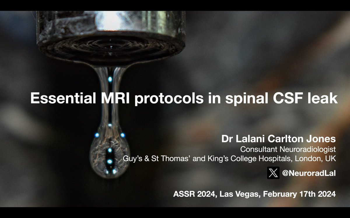 NeuroradLal's tweet image. Want to find out how to work up #spinalCSFleak #SIH &amp;amp; how focused MR can help. me &amp;amp;  CSF leak experts @AndrewCallenMD @dgleao @nbefera @MarkMamloukMD in an hour @The_ASSR #ASSR24