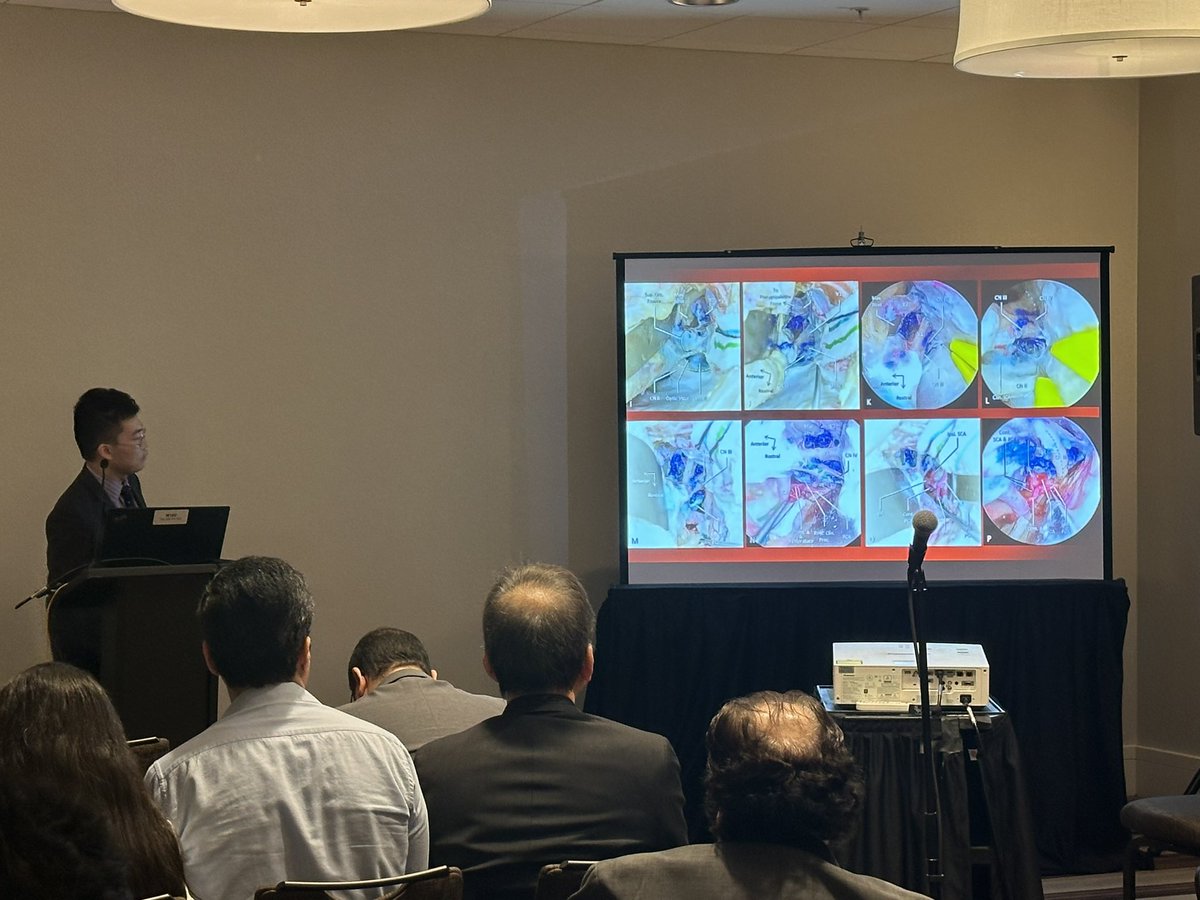 Great talk by @kz_neurosurgery this morning @NASBSorg describing his technique for The Eyelid Trans-orbital Trans-cavernous Approach to the Basilar Apex, a Cadaveric Proof-of-concept Study: New Perspective @OU_Neurosurgery @OUNeuroscience