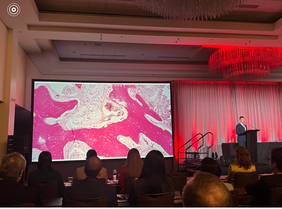 Ezequiel Goldschmidt (@ezegoldschmidt) on Twitter photo Presenting our work on hyperostotic meningiomas at NASBS Presenting our work on hyperostotic meningiomas at NASBS