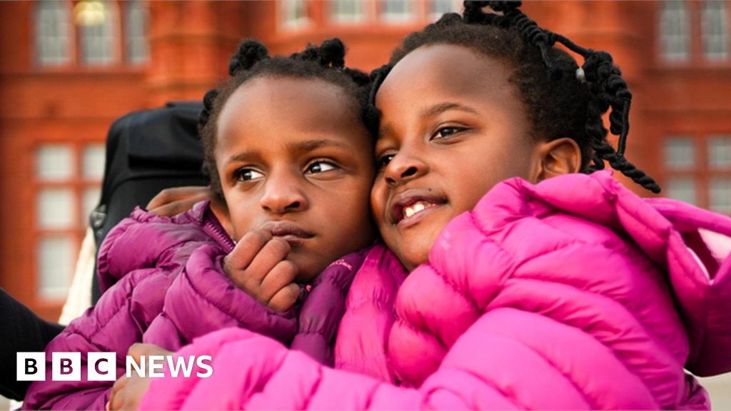 swissbusiness's tweet photo. Conjoined twins given days to live are proving everyone wrong https://t.co/KmILlBM2B9 https://t.co/KUOOKJpEA3
