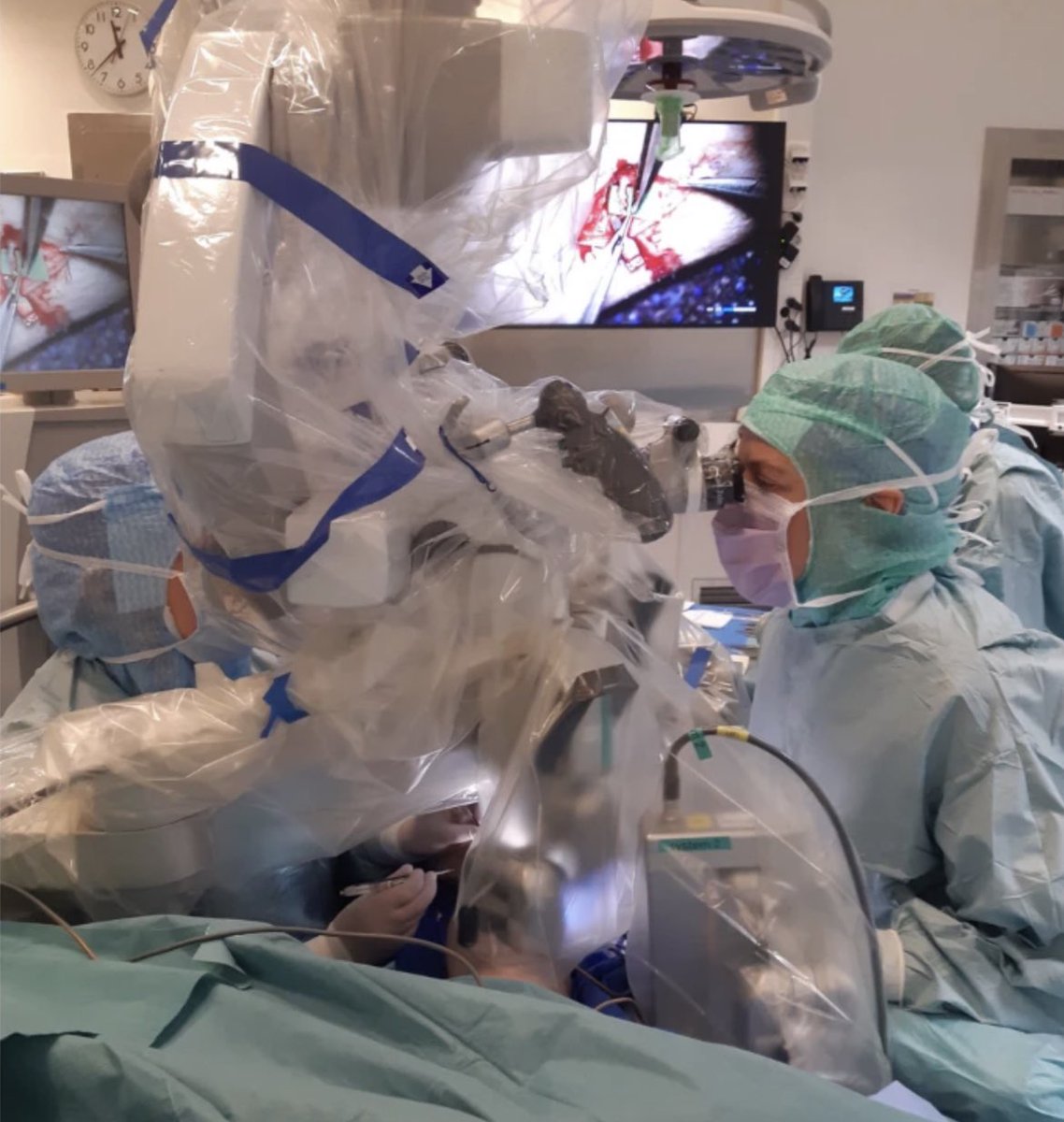 Implementation of robot-assisted lymphaticovenous anastomoses in a microsurgical unit <a href="/uppsalauni/">Uppsala universitet</a> 

OPEN ACCESS! From Sweden 🇸🇪 

link.springer.com/article/10.100…