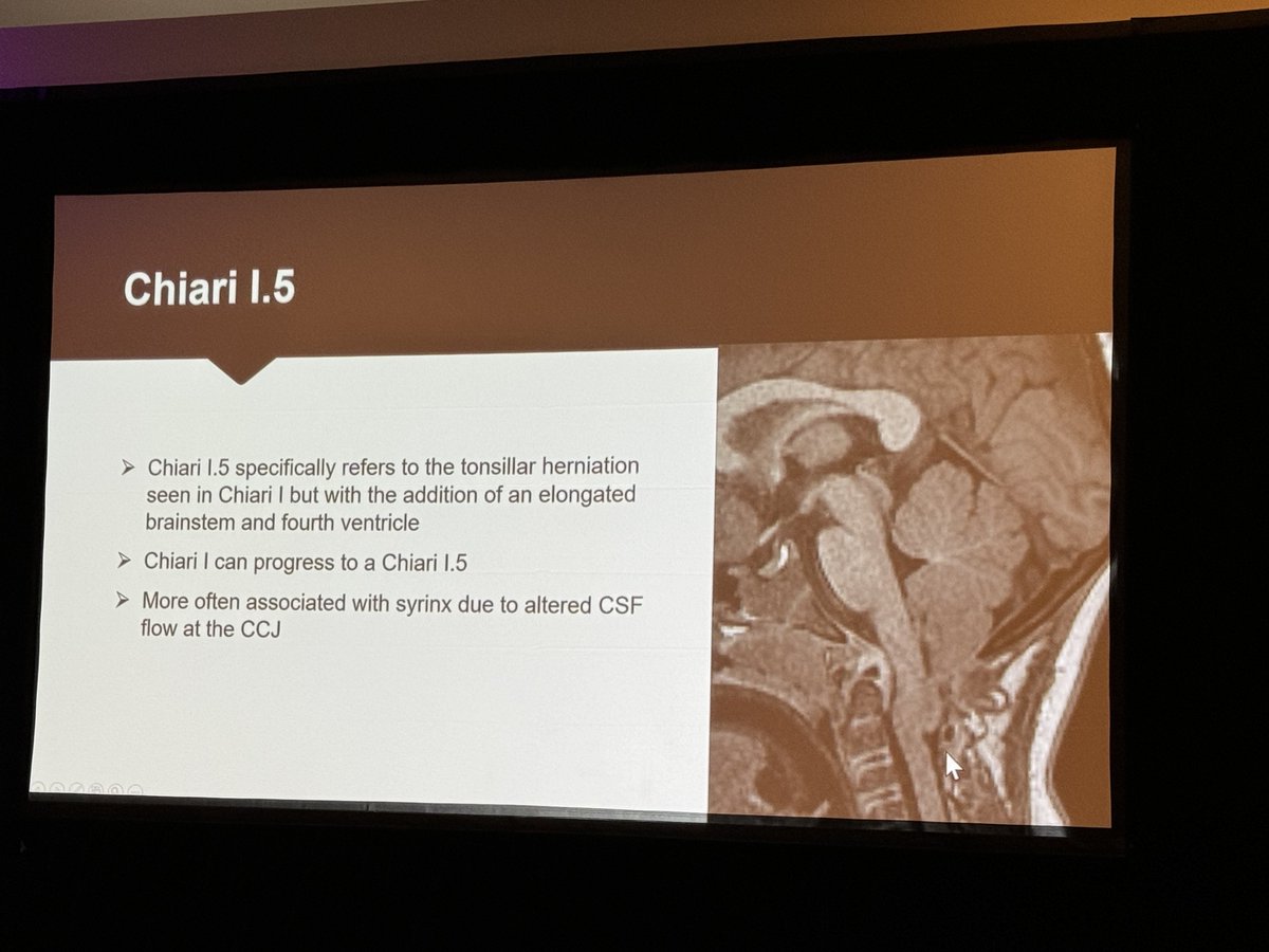 Don’t want to miss the awesome @laura1127md Controversial Chiari! 

Chiari I is not a malformation!

Come join me if you're attending American Society of Spine Radiology (ASSR) 27th Annual Symposium. #ASSR24 #NeuroRad - via #Whova event app
