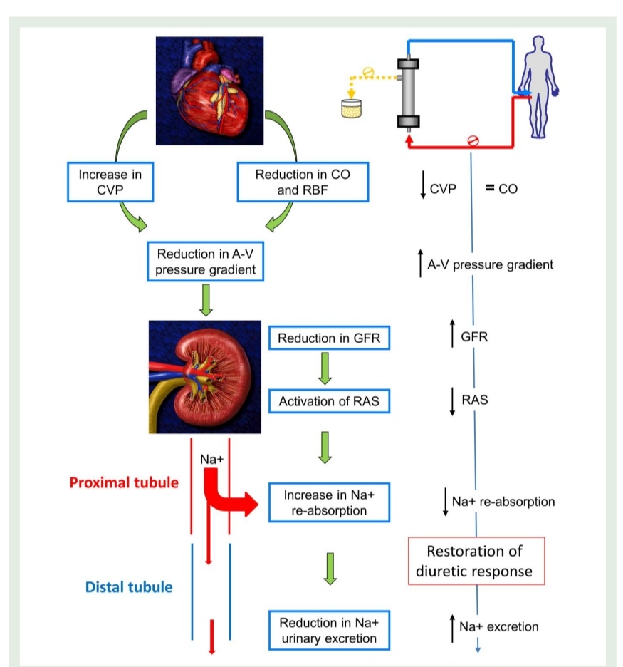 SOMELaguna's tweet photo. Balance de Líquidos en Falla Cardíaca 🫀💧

🔰📚European Journal of Preventive Cardiology 2023

https://t.co/szBLzsJpJg

Enlace a Artículo Completo 👇🏼✅🆓https://t.co/rPEDXf5xvO https://t.co/vOJR3u98gd